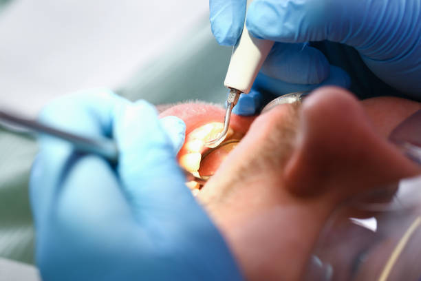 Best Emergency Gum Treatment in Northfield, IL